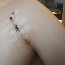 S&aring; h&auml;r g&aring;r det om man inte landar p&aring; skidorna . Foto: Bobby Jaksas. &Aring;kare: Henrik Thunborg.