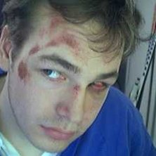 En till p&aring; h&auml;ndelsen med ansiktet. &Aring;kare: Peter Strandberg.