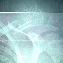 ov&auml;rt. Foto: R&ouml;ntgenwoman. &Aring;kare: mazter.