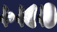 Framtidens ryggskydd – En airbag?