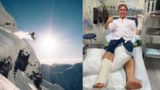 Nikolai Schirmer bröt käkbenet första skiddagen